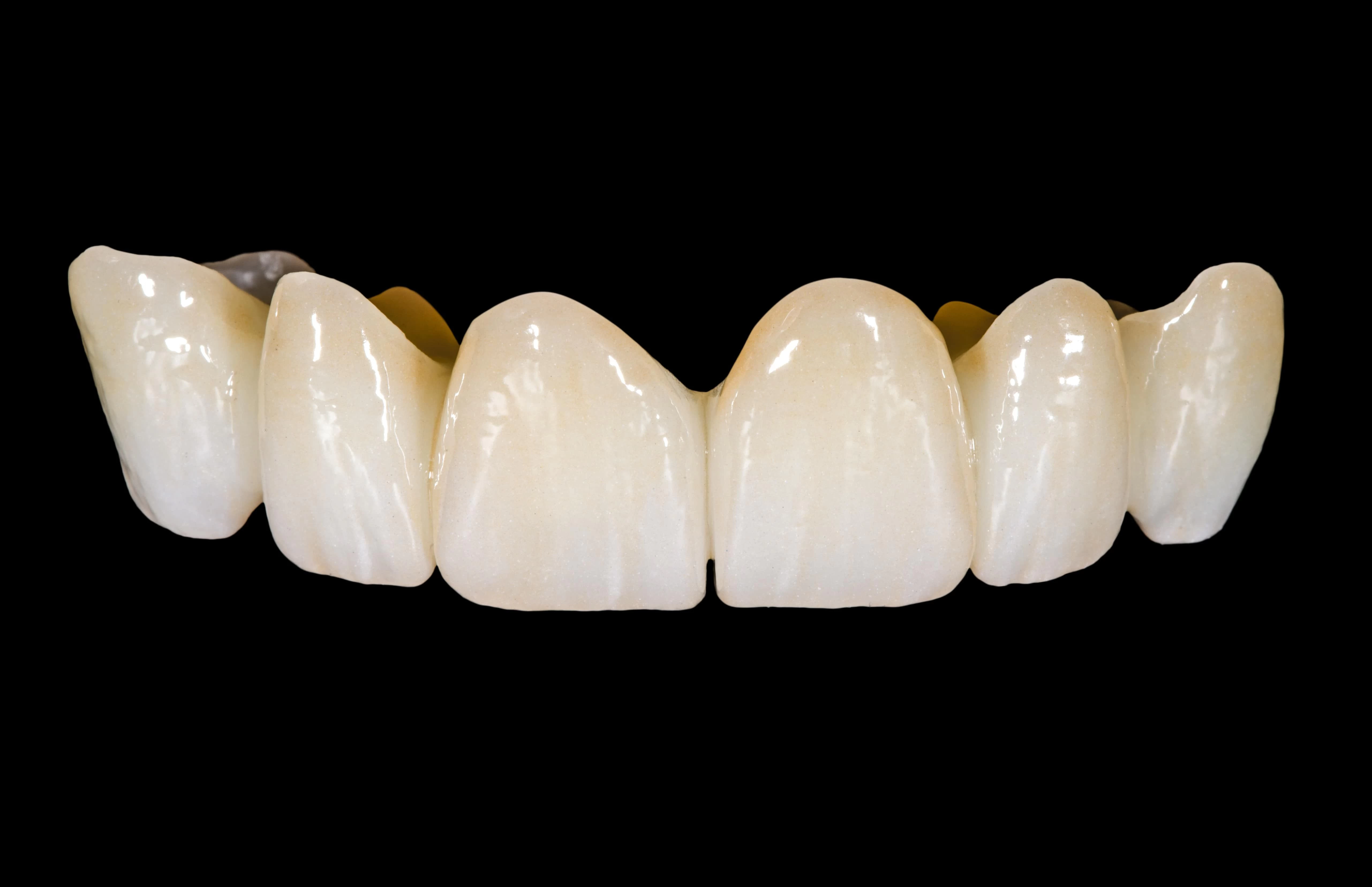 Răng sứ Zirconia